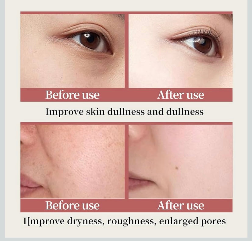 6 Piece Hydrating Vitamin C Skincare Set